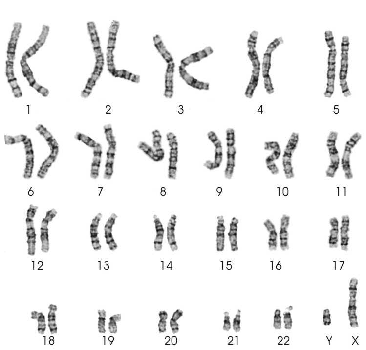 chromosomen.jpg
